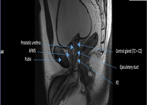 Prostate Mri Anatomy AtPCa Net Anatomical Aware Prostate Cancer