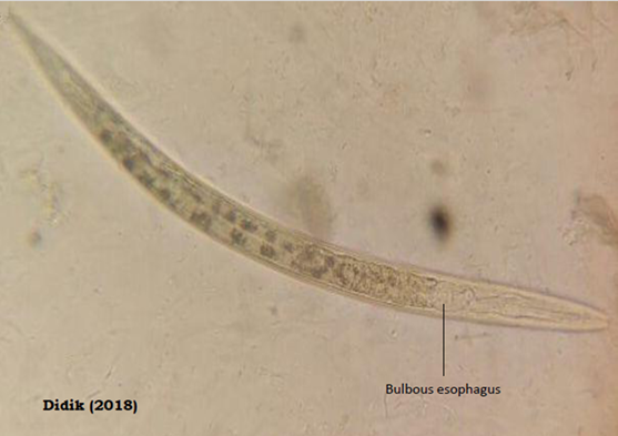 enterobius vermicularis és trudnoci)