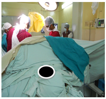 An unexpected cause of intraoperative tachycardia - a case report ...